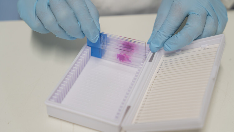 Breast Cancer Now Biobank research environment
