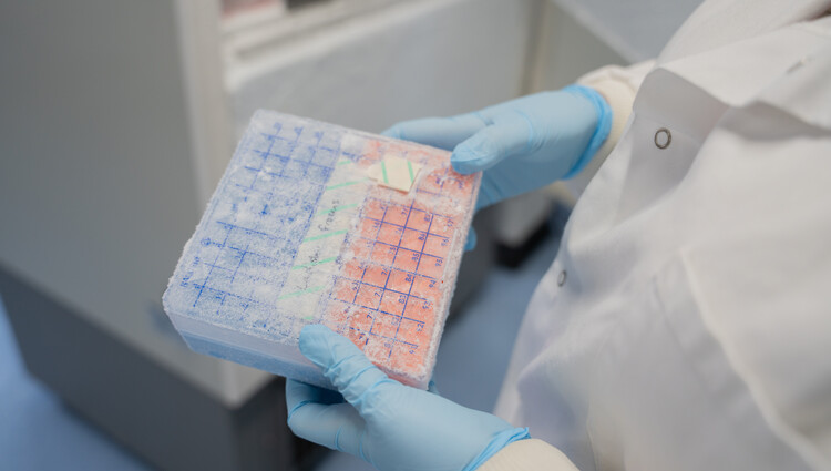 Breast Cancer Now Biobank research environment